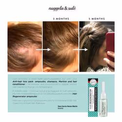 Nuggela & Sulé 1401-61559 produit pour la croissance des cheveux 10 ml Unisexe - Vue supplémentaire 3
