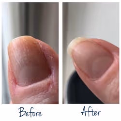 SOS Ongles abimés 7ml Herome - Vue supplémentaire 3