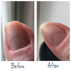 SOS Ongles abimés 7ml Herome